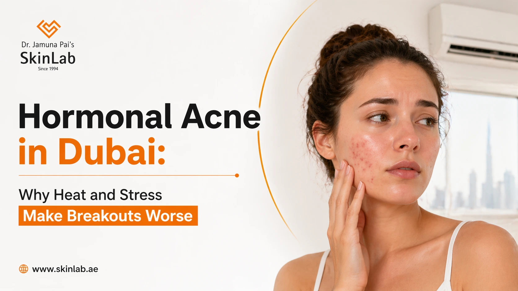 Hormonal Acne in Dubai: Why Heat and Stress Make Breakouts Worse