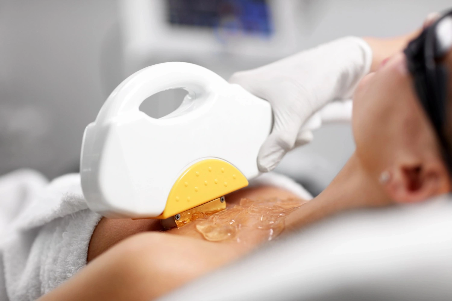 Hydrofacial treatment