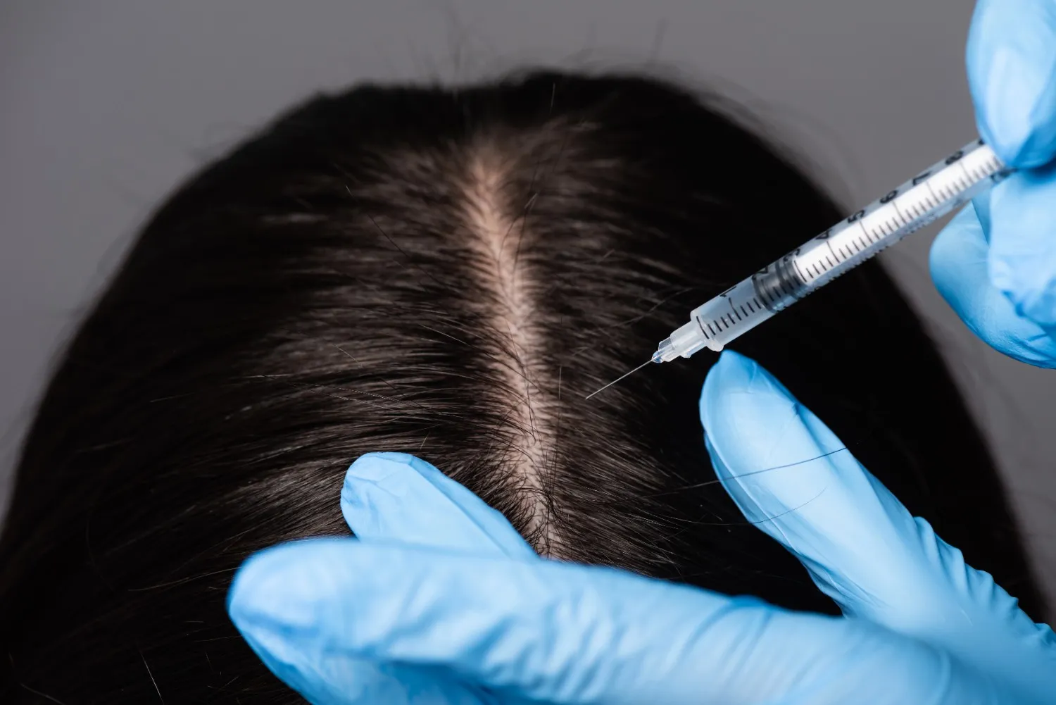 Hydrofacial treatment