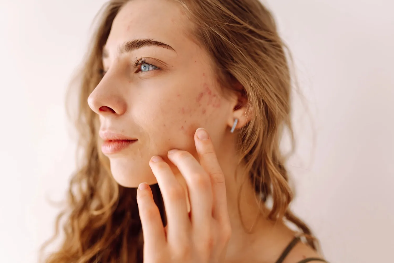 Hydrofacial treatment