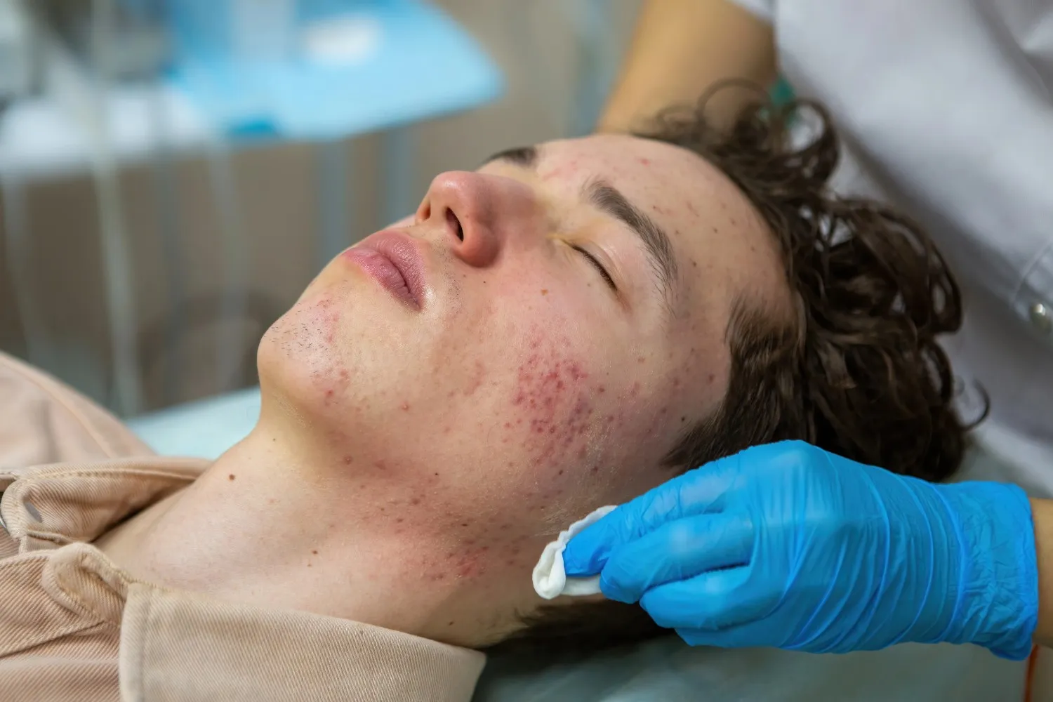 Hydrofacial treatment