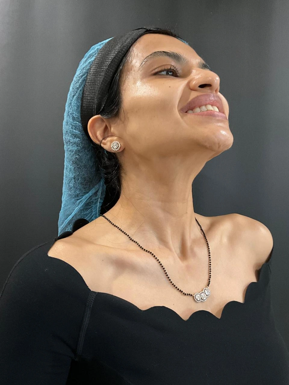 After Botox