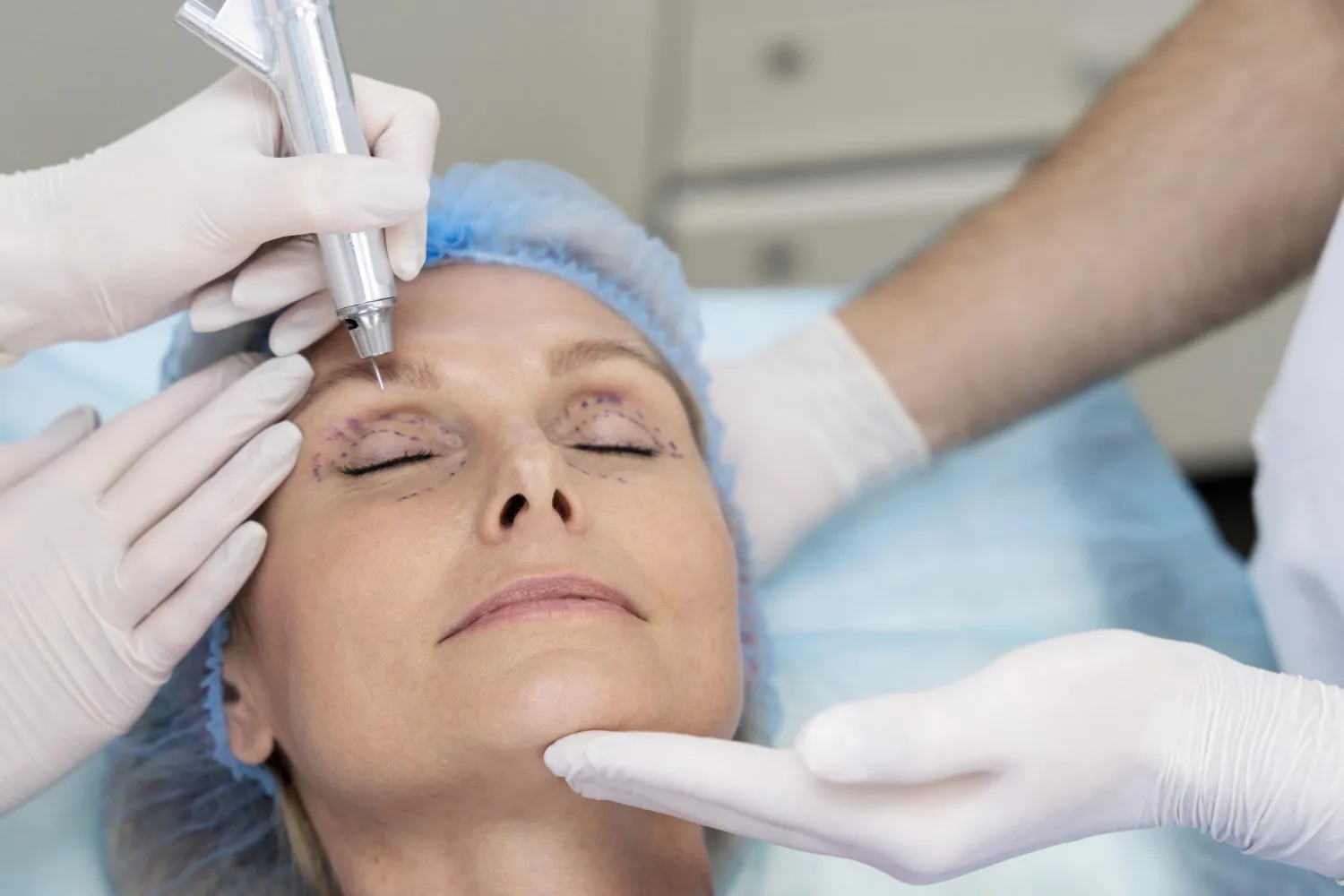 Hydrofacial treatment