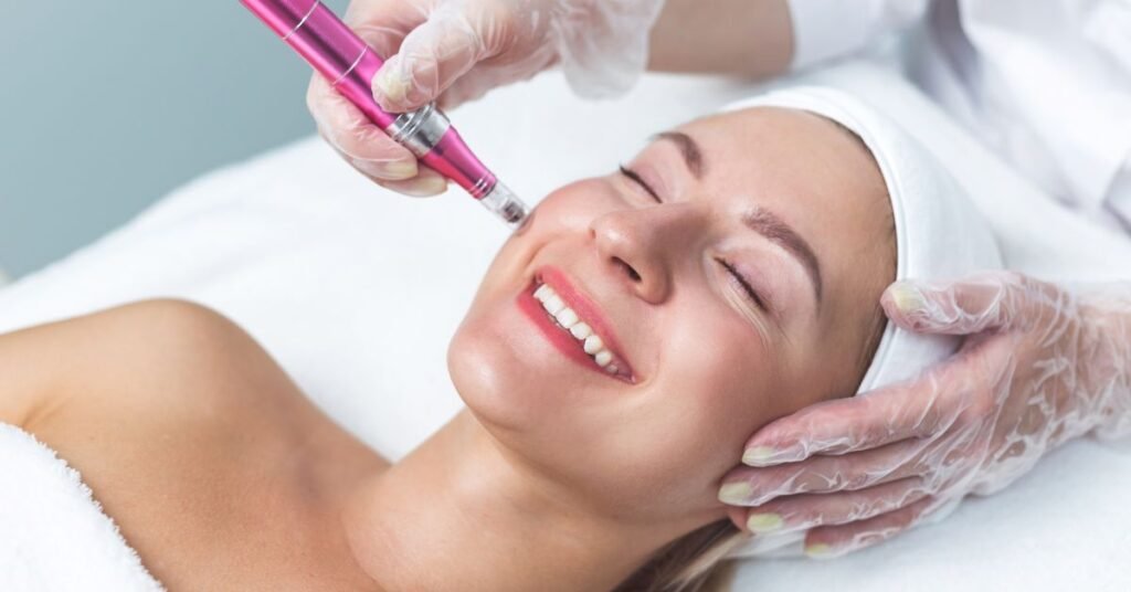 acne scar treatment